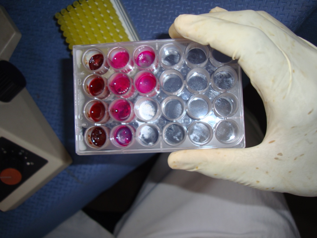 Ethnobotanical research on medicinal plants for helminthic infections